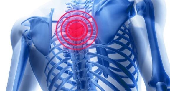 Liječenje osteohondroze torakalne kralježnice