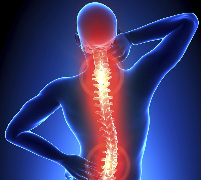 Osteohondroza kralježnice