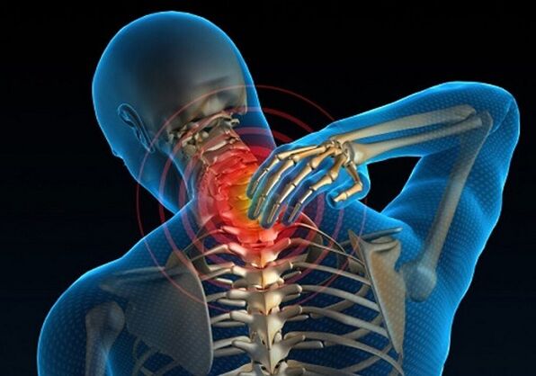 bol u vratu zbog osteohondroze